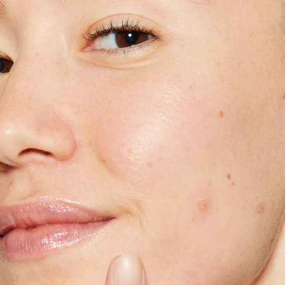 Dermalogica Deep Breakout Liquid Patch